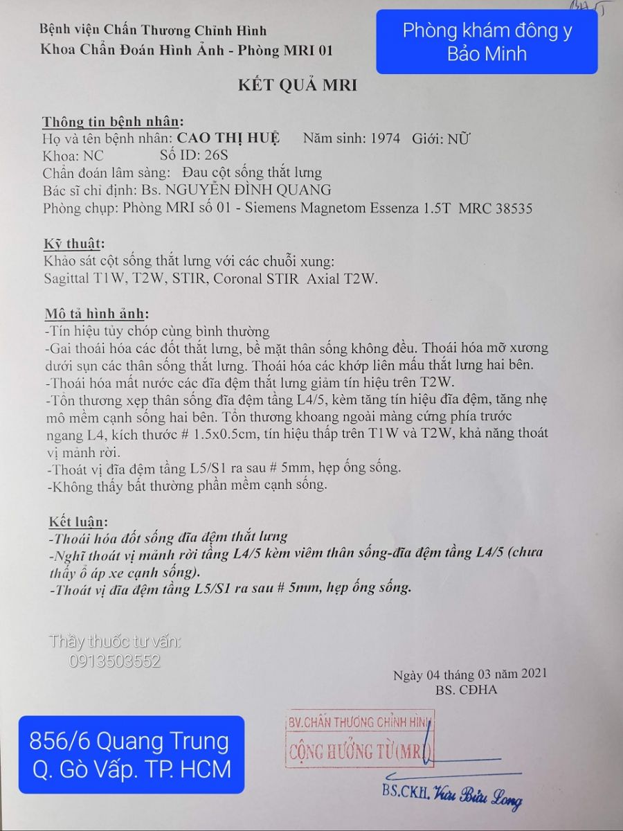 Chữa khỏi thoát vị đĩa đệm 